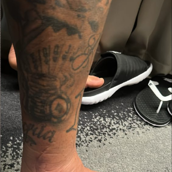 Pé inchado de Neymar choca internautas