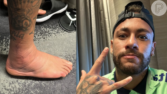 Neymar mostra pé machucado durante jogo do Brasil, em 26 de novembro de 2022