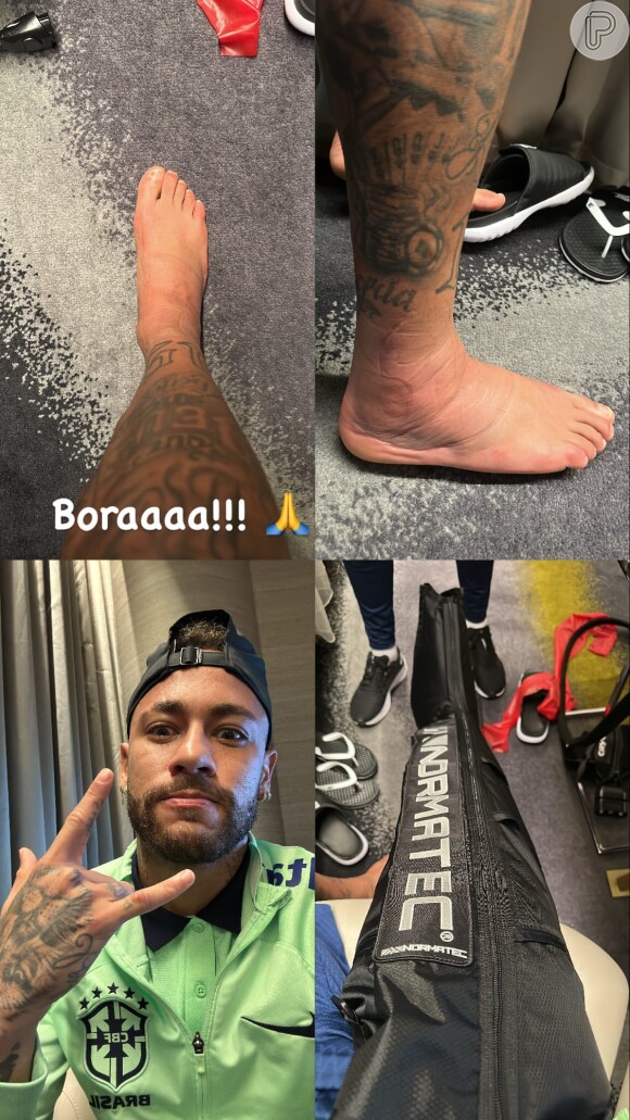Neymar mostra evolução do tratamento do pé machucado