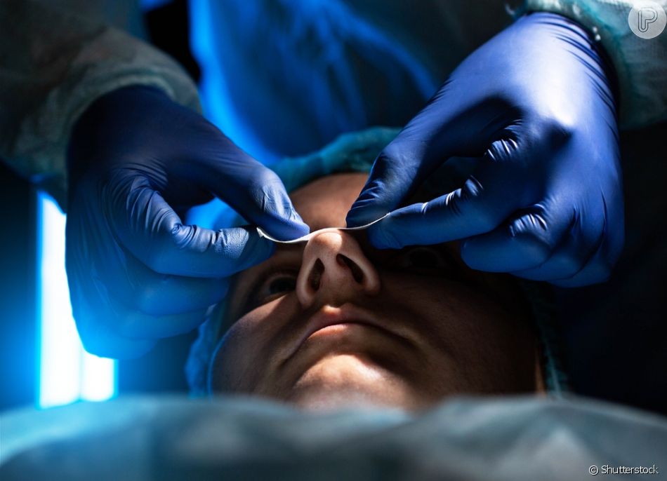 Rinoplastia Pode Melhorar A Respira O Cirurgi O Responde E Cita Caso