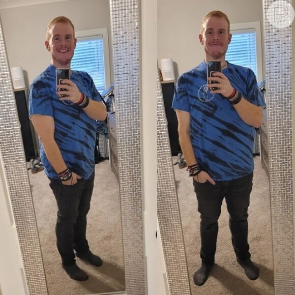 Fotos de antes e depois: Casey King compartilha em sua rede social a mudança do seu corpo