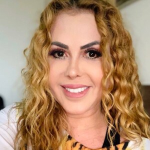 Joelma tratou inchaço no rosto, causado por sequelas da Covid-19, durante internação