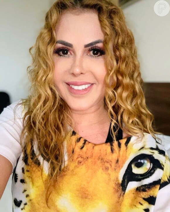 Joelma tratou inchaço no rosto, causado por sequelas da Covid-19, durante internação