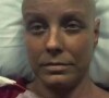 Claudia Conserva foi diagnosticada com câncer severo em junho de 2022