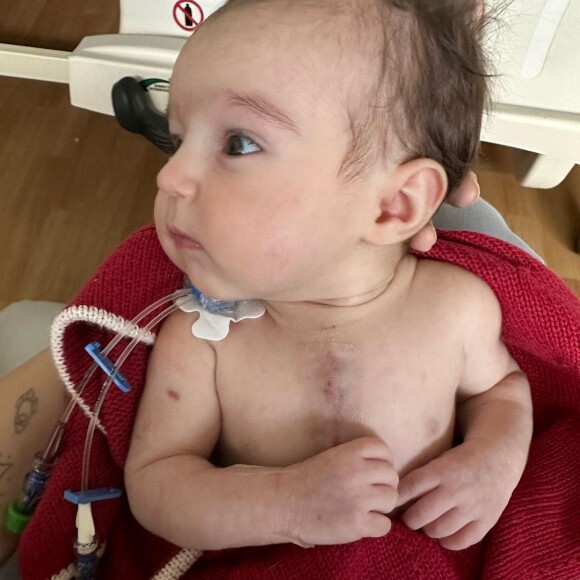 Filha de Thaila Ayala e Renato Góes ficou com cicatriz no peito após passar por cirurgia cardíaca