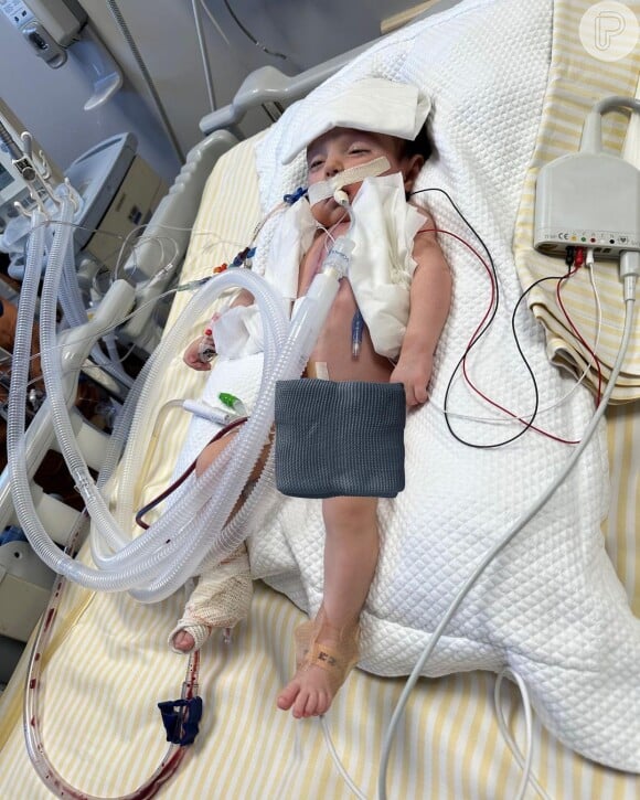 Filha de Thaila Ayala enfrentou uma cirurgia no coração com 2 meses de vida