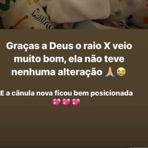 Mulher de Juliano Cazarré exaltou Deus ter cuidado da sua filha que poderia ter morrido.