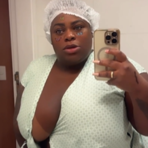 Jojo Todynho passou por uma cirurgia bariátrica