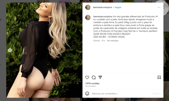 'Bumbum perfeito': Joice Hasselmann afirma que o cuidado com a pele é um dos diferenciais do seu protocolo