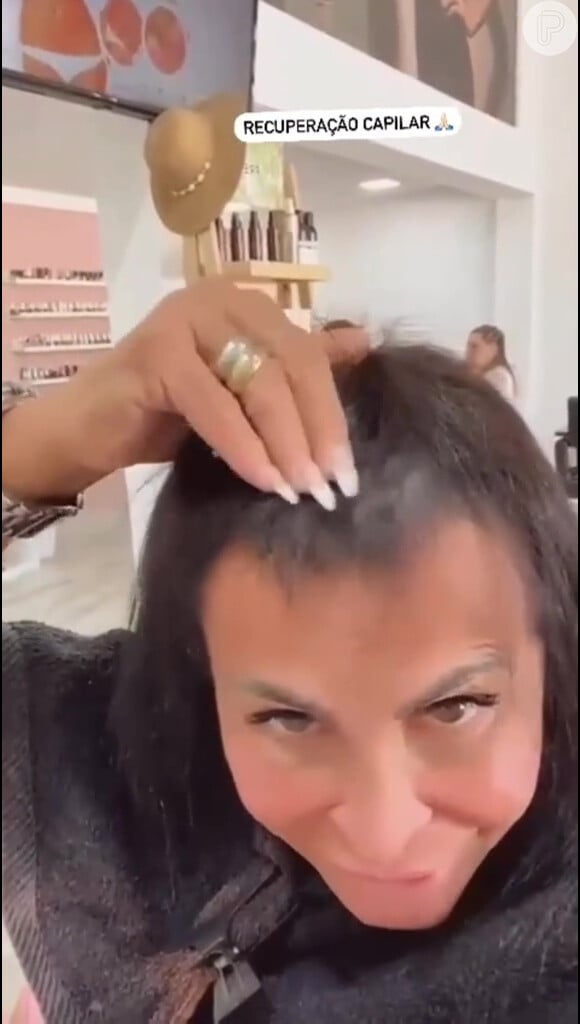 Gretchen passou por um corte químico recentemente, o que fez com ela perdesse muitos fios na região frontal do couro cabeludo