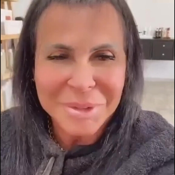 Gretchen mostrou o couro cabeludo já preenchido e comemorou o sucesso do tratamento