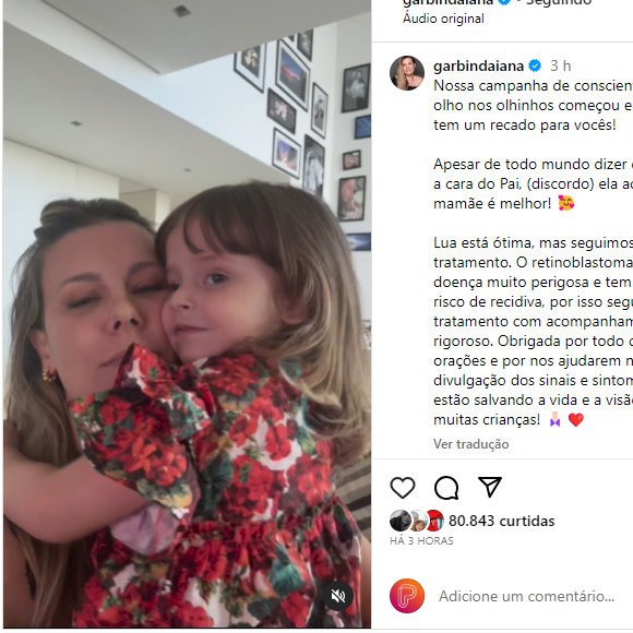 Diana Garbin fez um post no Instagram para conscientizar sobre a retinoblastoma