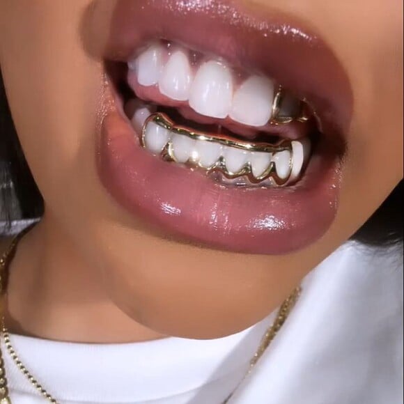 Ludmilla surgiu com um grillz de ouro na boca