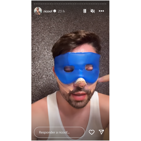 Rico Melquiades sofreu um acidente de carro, machucou feio o nariz e resolveu fazer um procedimento estético que ja´queria fazer