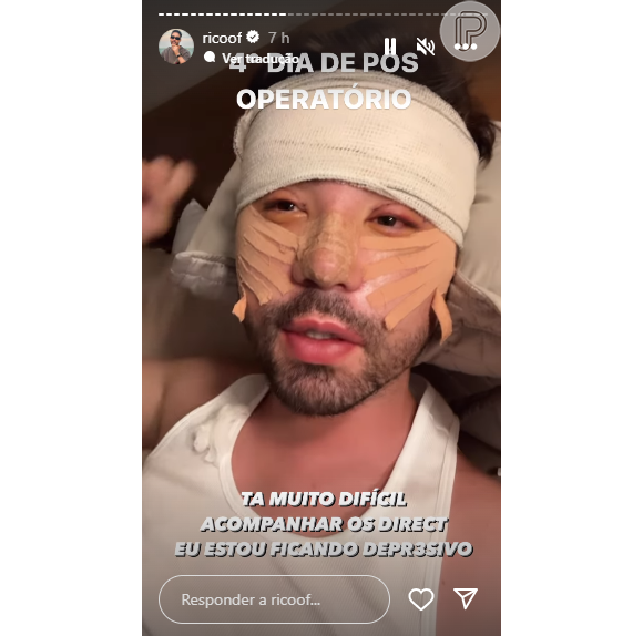 Rico Melquiades revela como está sendo o seu processo pós-operatório