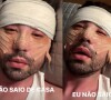'Internet vai acabar comigo': Rico Melquiades chora após receber críticas depois de fazer procedimento estético