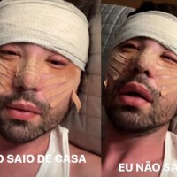 'Internet vai acabar comigo': Rico Melquiades chora após receber críticas depois de fazer procedimento estético