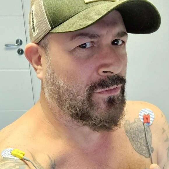 Mingau, do Ultraje a Rigor, passou por duas cirurgias desde que levou um tiro na cabeça em Paraty, Costa Verde do Rio de Janeiro