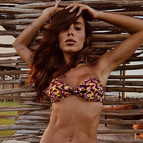 Detalhe no rosto de Anitta, com sardas, chamou atenção de fãs que comentaram o detalhe