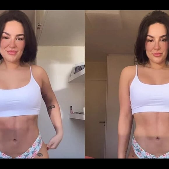 Tratamento feito por Kéfera Buchmann usa uma quantidade maior na parte superior do bumbum, procedimento completamente seguro e muito procurado atualmente.