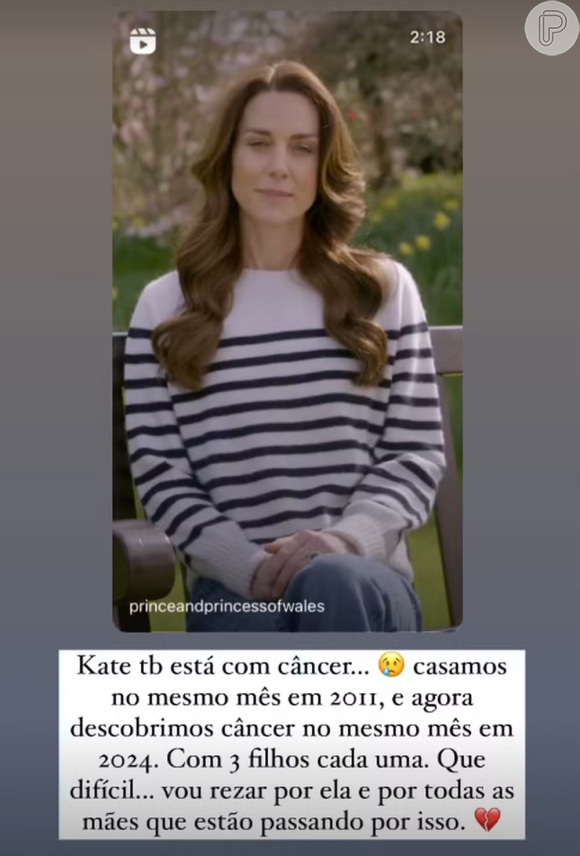 Com Leucemia, Fabiana Justus revela semelhanças com Kate Middleton, diagnosticada com câncer