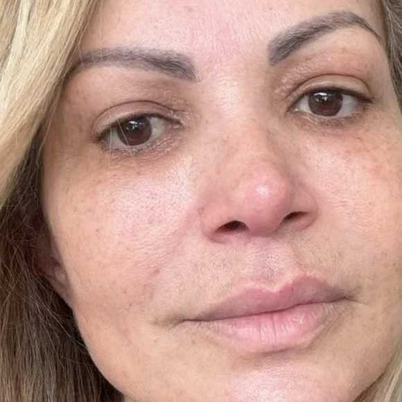 Estado de saúde de Solange Almeida: cantora permanecerá afastada dos palcos e real motivo de operação vem à tona