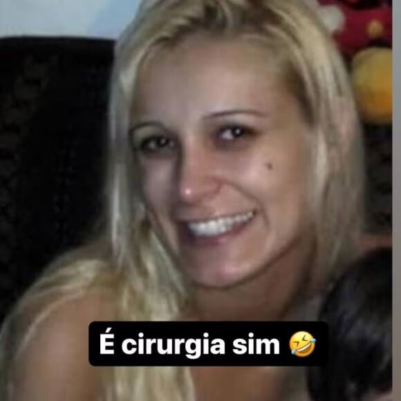 Andressa Urach passou por inúmeras cirurgias plásticas e procedimentos estéticos ao longo da vida