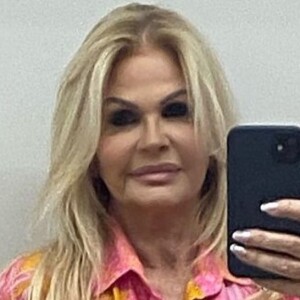 Monique Evans passa por procedimento estético e divide opiniões da internet