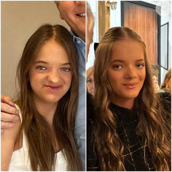 Antes e depois de Rafaella Justus impressionou a internet e a menina recebeu duras críticas na web