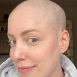 Fabiana Justus já havia confessado recentemente estar curiosa para saber como seus cabelos iriam nascer após o transplante