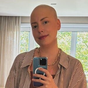 Fabiana Justus mostra cabelos nascendo e comemora avanço em tratamento de câncer