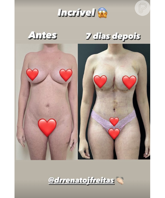 Corpo de Bárbara Evans já apresentava mudanças significativas desde a primeira semana