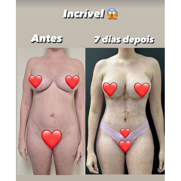 Corpo de Bárbara Evans já apresentava mudanças significativas desde a primeira semana