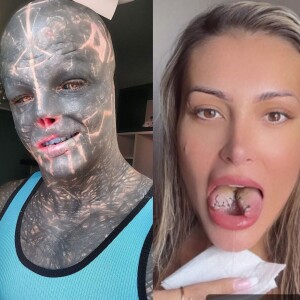 Além de Andressa Urach, confira 7 famosos (ou subcelebridades) que exageraram em cirurgias