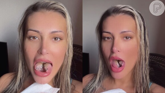 Andressa Urach está causando polêmica na web com sua bifurcação na língua, dividindo o órgão em dois; separamos outros famosos que também dão o que falar sobre o assunto