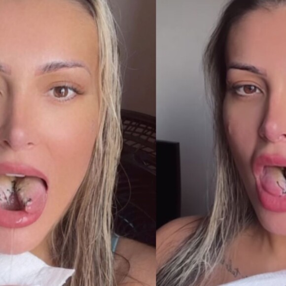 Andressa Urach está causando polêmica na web com sua bifurcação na língua, dividindo o órgão em dois; separamos outros famosos que também dão o que falar sobre o assunto