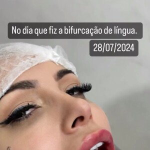 Andressa Urach: cirurgia de bifurcação da língua causou reações mistas na web