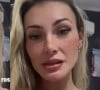 Andressa Urach faz tatuagem de sarda no rosto e choca web: 'Não dá para defender'