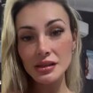 Gente? Andressa Urach causa novamente na web após tatuar sardas no próprio rosto: 'Cada dia mais difícil defender'