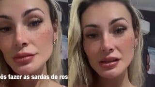 Gente? Andressa Urach causa novamente na web após tatuar sardas no próprio rosto: 'Cada dia mais difícil defender'