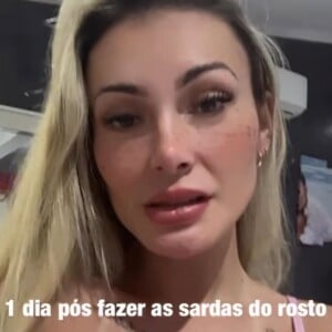 Andressa Urach mostra sardas tatuadas em seu rosto