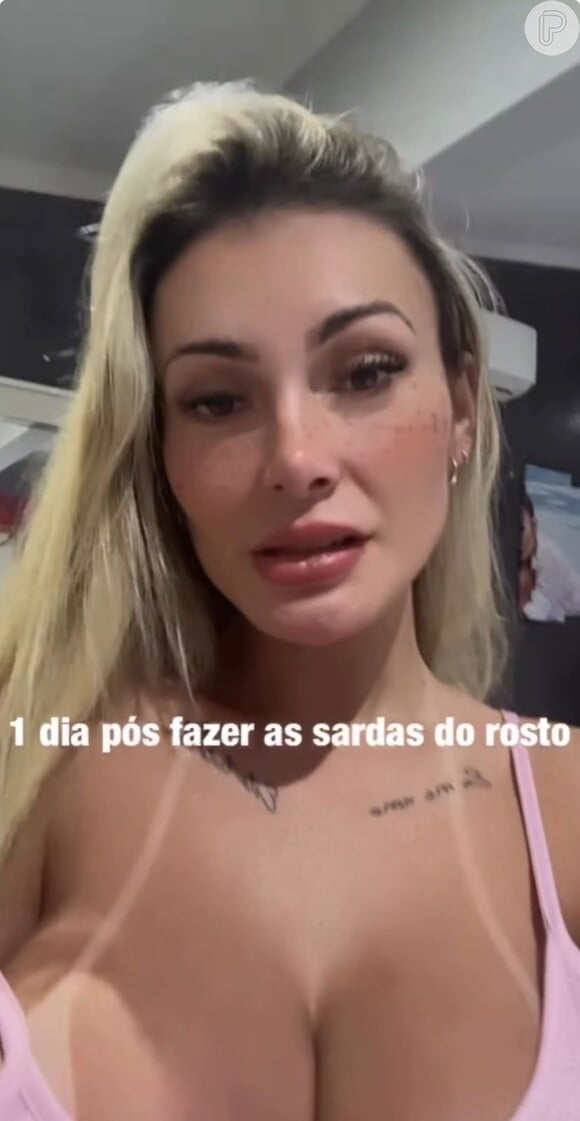 Andressa Urach mostra sardas tatuadas em seu rosto