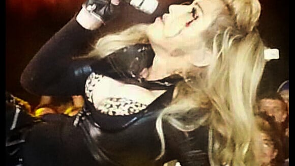 Madonna leva soco no rosto e canta sangrando em show na Colômbia