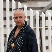 Betty Lago comenta visual em tratamento contra o câncer: 'Me acho linda'