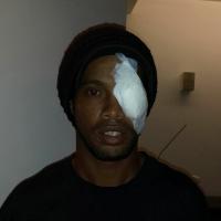 Ronaldinho Gaúcho publica foto com curativo no olho e avisa: 'Estou bem!'