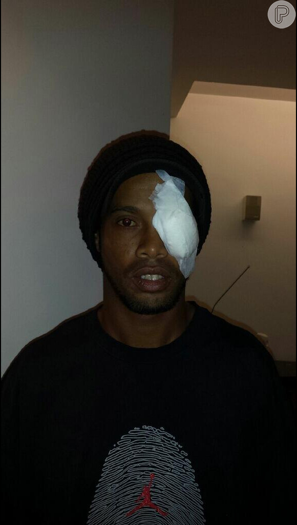 Ronaldinho Gaúcho machucou o olho no jogo do Atletico-MG contra o Tijuana e postou foto do curativo em sua conta do Twitter em 27 de maio de 2013