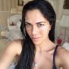 Daniela Albuquerque tirou a maquiagem e compartilhou foto exibindo o melasma em seu rosto