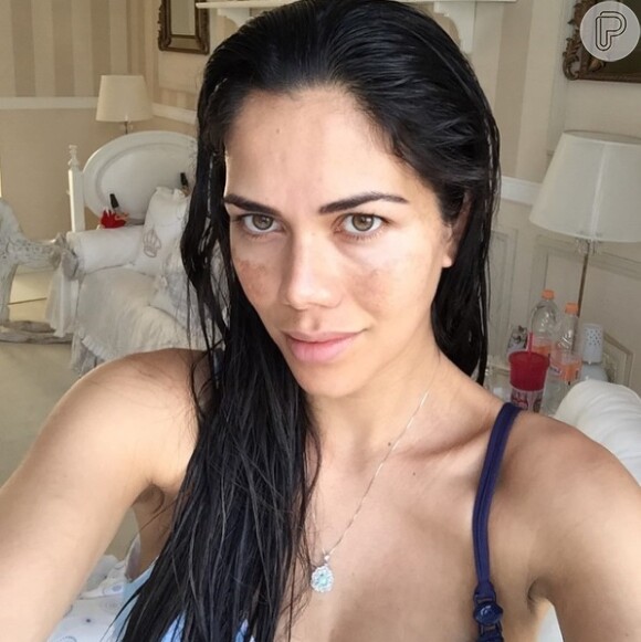 Daniela Albuquerque tirou a maquiagem e compartilhou foto exibindo o melasma em seu rosto