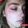 Amber Heard acusa Johnny Deep de violência doméstica: ele teria atirado um celular em seu rosto