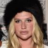 A cantora Kesha tem o rosto repleto de sardas e não faz questão de escondê-las